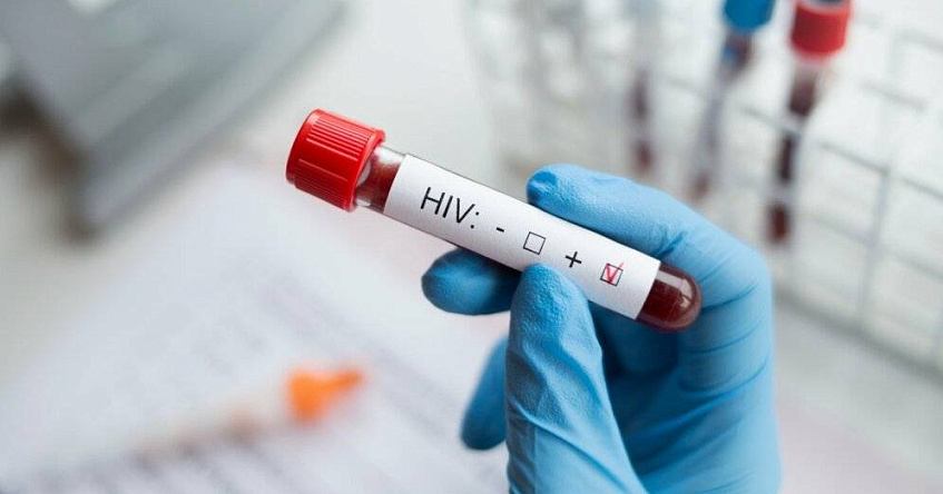 В Истре 75 новых случаев заражения ВИЧ