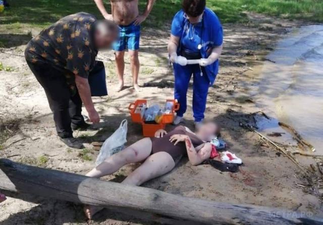 На женщину с ребёнком упало дерево на пляже Истринского водохранилища